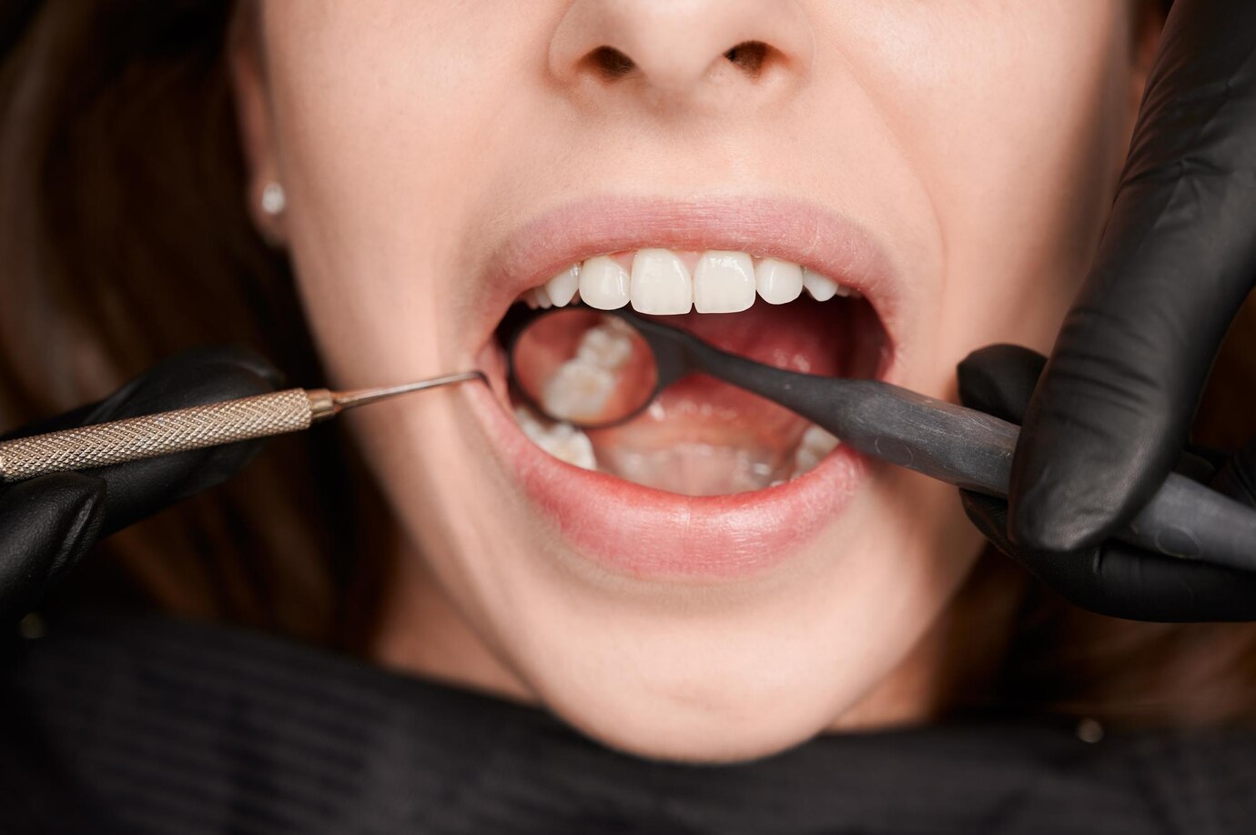 Diabetes can impact oral health - here's what you need to know